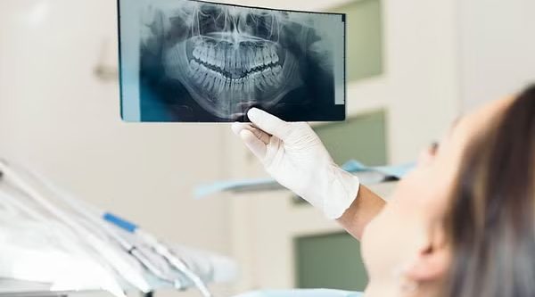 Digital Dental X-ray Digital Dental X-ray