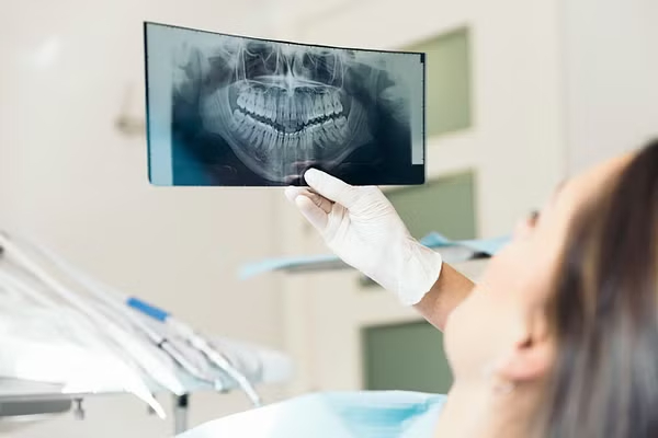 Digital Dental X-ray Digital Dental X-ray